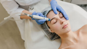 laser therapy for skin pigmentation