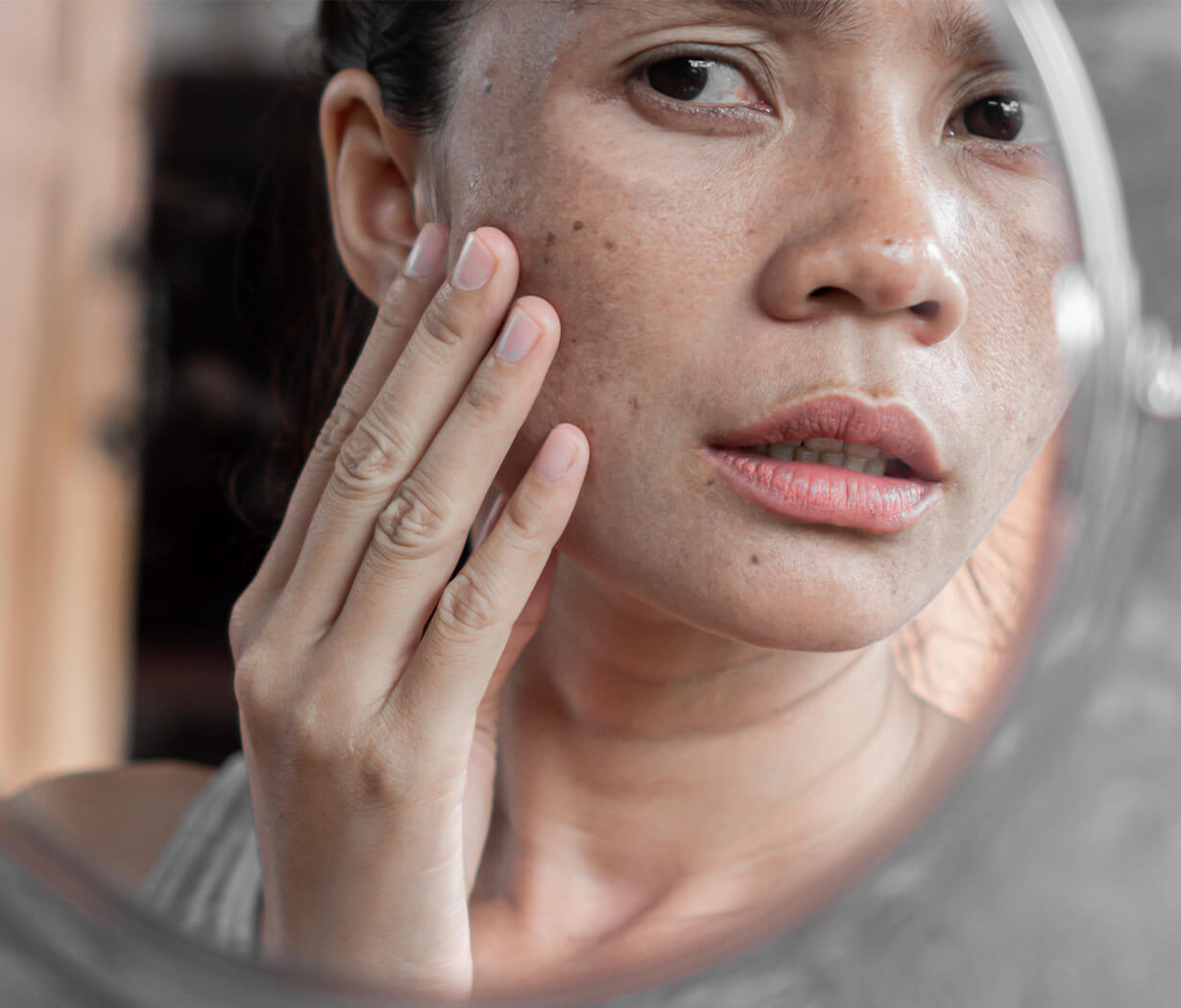 Acne Skin Control Serum